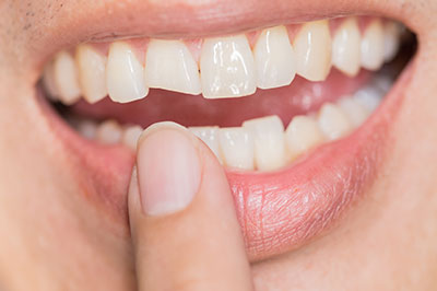All Smiles Dental Care | Preventative Program, Pediatric Dentistry and CBCT
