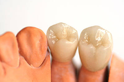 All Smiles Dental Care | Veneers, Teeth Whitening and Dentures
